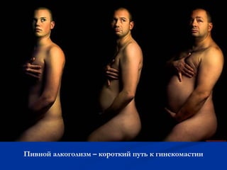 Пивной алкоголизм – короткий путь к гинекомастии 
 