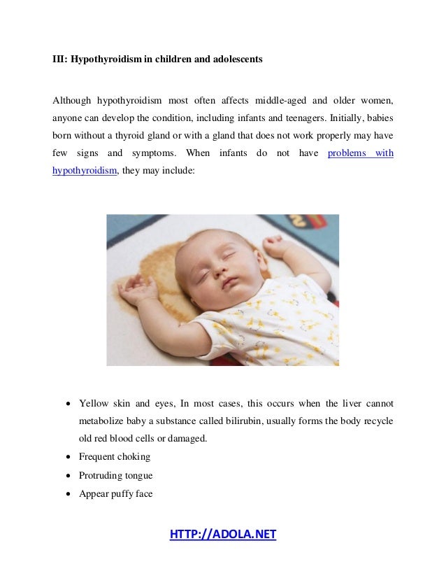 What Are The Signs And Symptoms Of Hypothyroidism?