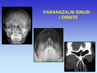 PARANAZALNI SINUSI i ORBITE  