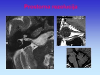 Prostorna rezolucija  