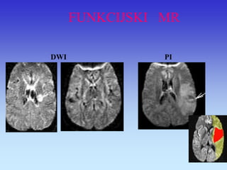FUNKCIJSKI MR 
PI 
DWI  