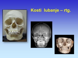 Kosti lubanje – rtg.  