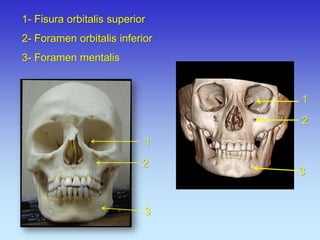 1- Fisura orbitalis superior 2- Foramen orbitalis inferior 3- Foramen mentalis 
1 
2 
3 
1 
2 
3  