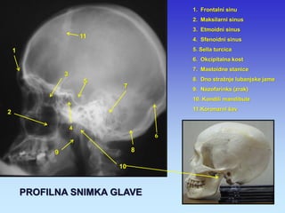 1. Frontalni sinu 
2. Maksilarni sinus 
3. Etmoidni sinus 
4. Sfenoidni sinus 
5. Sella turcica 
6. Okcipitalna kost 
7. Mastoidne stanice 
8. Dno stražnje lubanjske jame 
9. Nazofarinks (zrak) 
10. Kondili mandibule 
11.Koronarni šav 
10 
9 
1 
2 
3 
4 
5 
6 
7 
8 
11 
PROFILNA SNIMKA GLAVE  