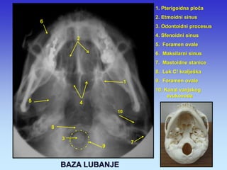 3 
2 
4 
6 
1. Pterigoidna ploča 2. Etmoidni sinus 3. Odontoidni procesus 4. Sfenoidni sinus 5. Foramen ovale 6. Maksilarni sinus 7. Mastoidne stanice 8. Luk C! kralješka 9. Foramen ovale 10. Kanal vanjskog zvukovoda 
7 
9 
1 
5 
8 
10 
BAZA LUBANJE  