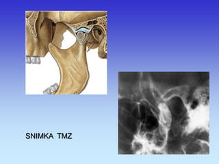 SNIMKA TMZ  
