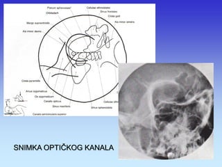 SNIMKA OPTIČKOG KANALA 
 
