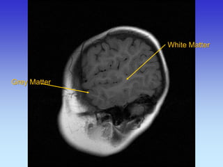 Grey Matter 
White Matter  