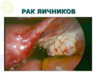 РРААКК ЯЯИИЧЧННИИККООВВ 
 