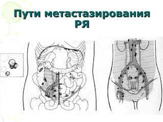 ППууттии ммееттаассттааззиирроовваанниияя 
РРЯЯ 
 