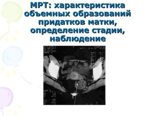 ММРРТТ:: ххааррааккттееррииссттииккаа 
ооббъъееммнныыхх ооббррааззоовваанниийй 
ппррииддааттккоовв ммааттккии,, 
ооппррееддееллееннииее ссттааддииии,, 
ннааббллююддееннииее 
 