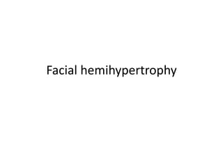 Facial hemihypertrophy
 