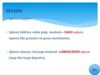 SPLEEN:
 Splenomegaly +
 Splenic follicles, white pulp involved—SAGO spleen:
tapioca like granules on gross examination.
 Splenic sinuses, red pulp involved– LARDACEOUS spleen
(map like-large deposits).
Qn
 