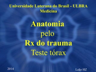 Leão HZ
Universidade Luterana do Brasil - ULBRA
Medicina
Anatomia
pelo
Rx do trauma
Teste tórax
2014
 