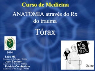 Curso de Medicina
ANATOMIA através do Rx
do trauma
Tórax
2014
Leão HZ
(Professor de Morfologia – ULBRA)
Juan Zambon
(Acadêmico de Medicina – ULBRA)
Patrícia Comberlato
(Acadêmica de Odontologia – PUCRS)
Quino
 