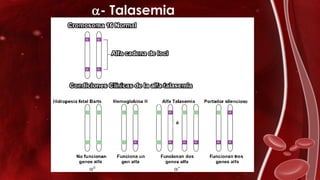 - Talasemia
o
0 +
 