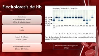 Electroforesis de Hb
Hemolisado
50 ul de eritrocitos lavados
450 ul de solución lisante
pH
8.4-8.6
Acetato de celulosa
Gel de Agarosa
Cámara de electroforesis
20 min. -200 Voltios
Hb normales corren por sus
cargas
 