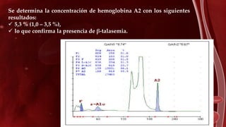 Se determina la concentración de hemoglobina A2 con los siguientes
resultados:
 5,3 % (1,0 – 3,5 %),
 lo que confirma la presencia de β-talasemia.
 