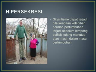 • Gigantisme dapat terjadi
bila keadaan kelebihan
hormon pertumbuhan
terjadi sebelum lempeng
epifisis tulang menutup
atau masih dalam masa
pertumbuhan.
 
