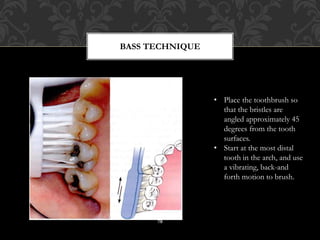 Bass Method PATIENT EDUCATION, MOTIVATION & ORAL HYGIENE INSTRUCTIONS | PPTX