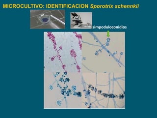 MICROCULTIVO: IDENTIFICACION Sporotrix schennkii
simpoduloconidios
 