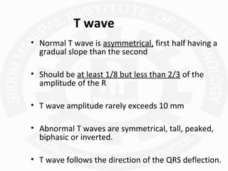 Normal T Wave Parameters ECG | PPT