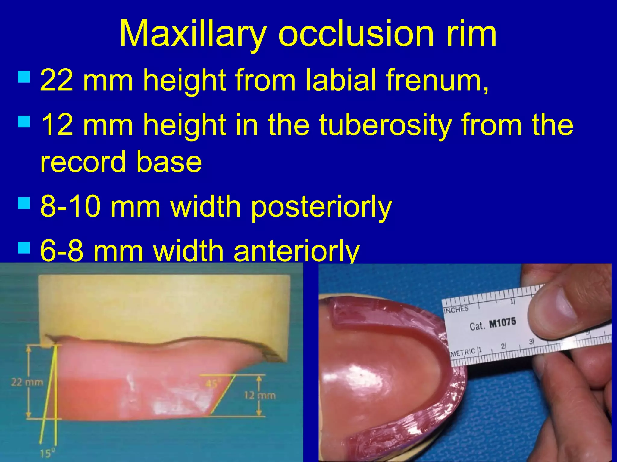 Oclusal Rim record bases & occlusal rims | PPT