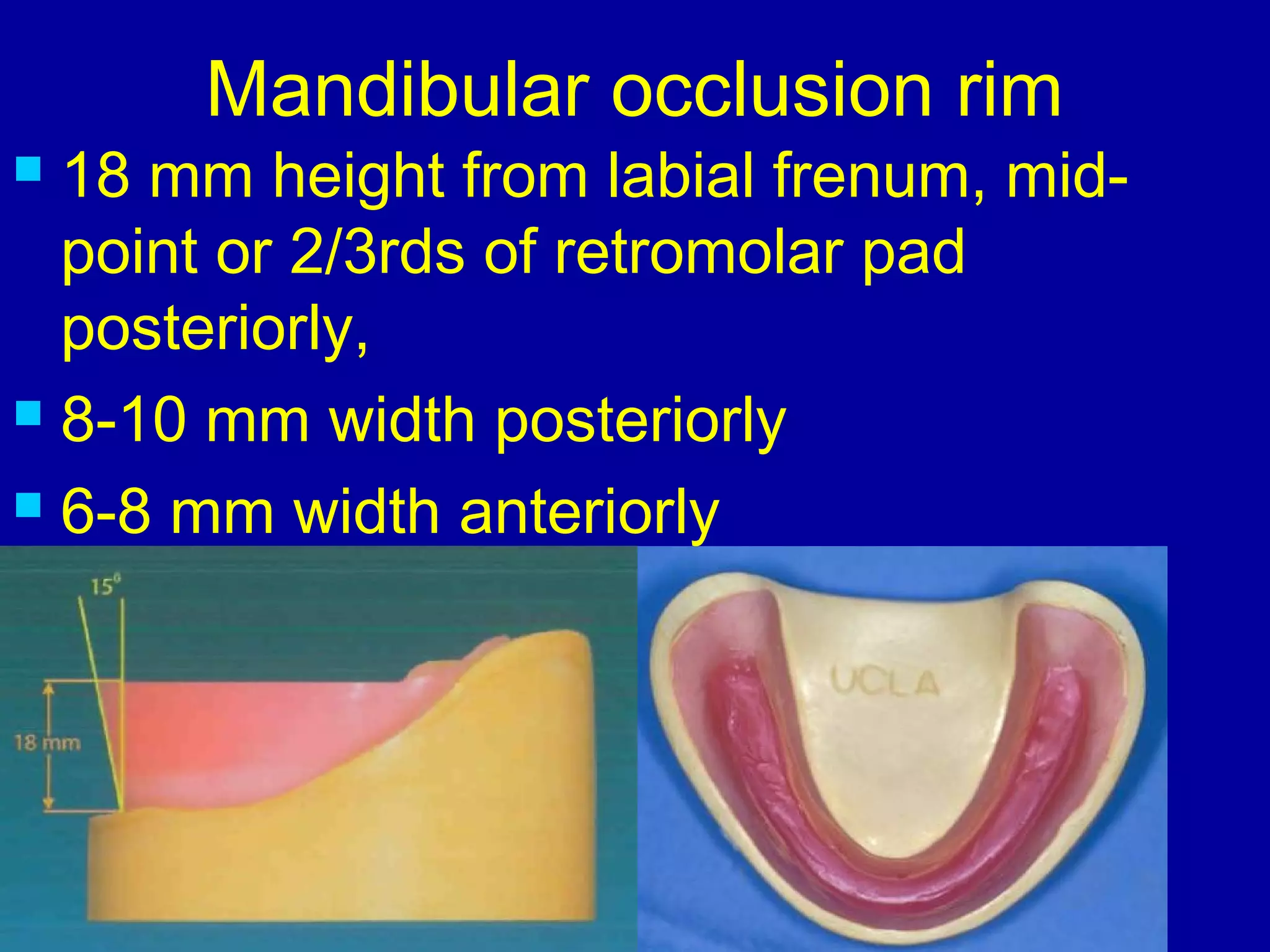 record bases & occlusal rims | PPT