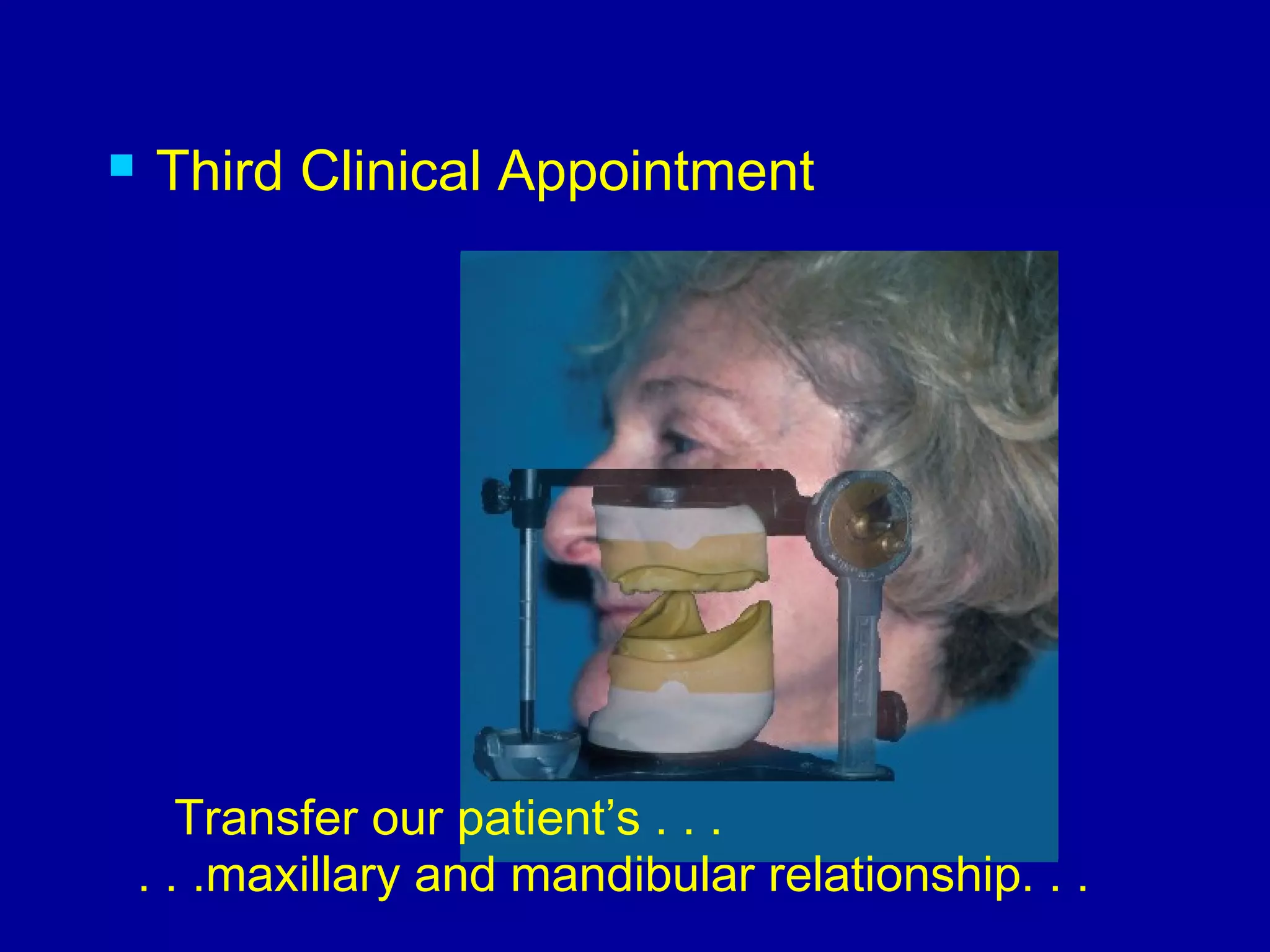 record bases & occlusal rims | PPT