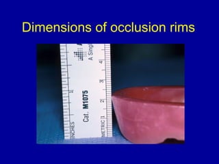 Oclusal Rim record bases & occlusal rims | PPT