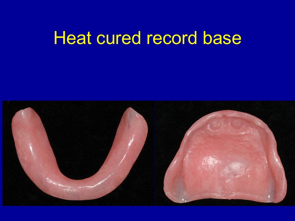 record bases & occlusal rims