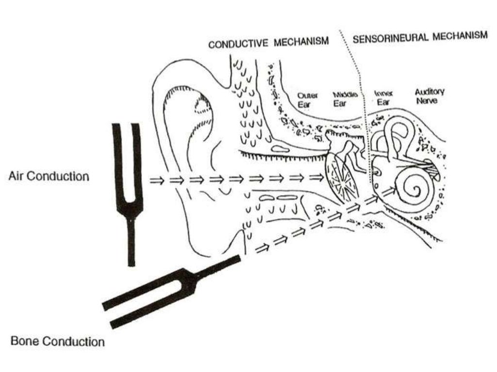 Tuning fork test