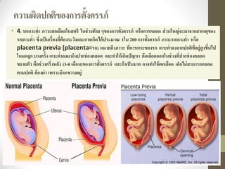 ความผิดปกติของการตั้งครรภ์
• 4.รกเกาะต่า ภาวะตกเลือดในสตรี ในช่วงท้าย ๆของการตั้งครรภ์ หรือการคลอด ส่วนใหญ่จะมาจากสาเหตุของ
รกเกาะต่า ซึ่งเป็นเรื่องที่ต้องระวังและอาจเกิดได้ประมาณ 1ใน 200 การตั้งครรภ์ ภาวะรกเกาะต่า หรือ
placenta previa (placenta=รก) หมายถึงภาวะ ที่การเกาะของรก เกาะต่าลงจากปกติที่อยู่สูงขึ้นไป
ในมดลูก บางครั้ง เกาะต่าลงมาถึงปากช่องคลอด และทาให้เกิดปัญหา คือเลือดออกในช่วงที่ปากช่องคลอด
ขยายตัว คือช่วงครึ่งหลัง (3-8 เดือน)ของการตั้งครรภ์ และถ้าเป็นมาก อาจทาให้ตกเลือด เด็กไม่สามารถคลอด
ตามปกติ ต้องผ่า เพราะมีรกขวางอยู่
 