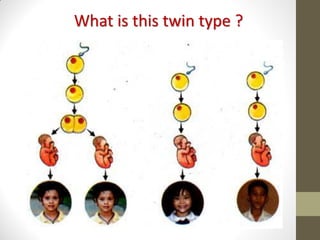 What is this twin type ?
 