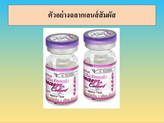 ตัวอย่ำงฉลำกเลนส์สัมผัส
 