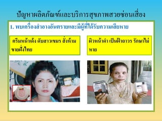 ปัญหาผลิตภัณฑ์และบริการสุขภาพสวยซ่อนเสี่ยง
1. พบเครื่องสำอำงอันตรำยและมีผู้ที่ได้รับควำมเสียหำย
ครีมหน้ำเด้ง ดับสำวเขมร สั่งห้ำม
ขำยฝั่งไทย
ผิวหน้ำดำ เป็นฝ้ ำถำวร รักษำไม่
หำย
 