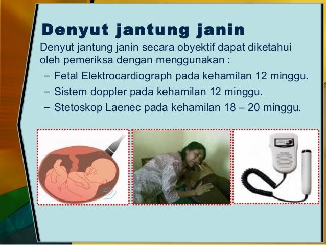 Ukuran Janin 12 Minggu - Y Soalan