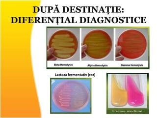 DUPĂ DESTINAȚIE:
DIFERENȚIAL DIAGNOSTICE
Lactoza fermentativ (roz)
 