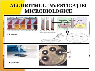 ALGORITMUL INVESTIGAȚIEI
MICROBIOLOGICE
 