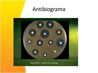 Antibiograma
 