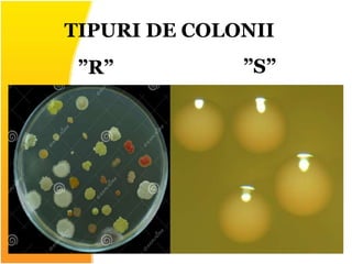 TIPURI DE COLONII
”R” ”S”
 