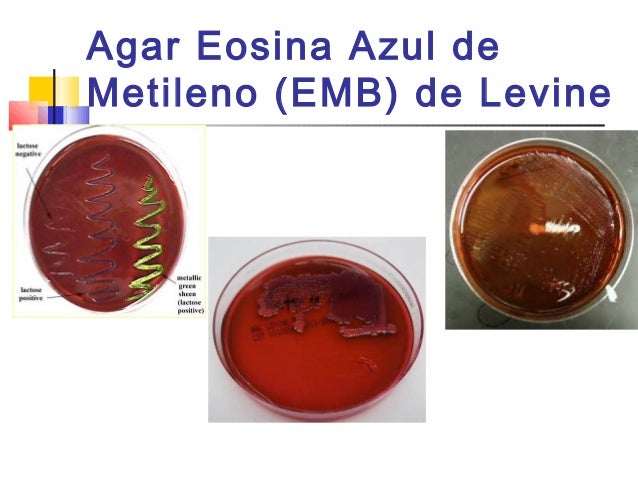 medios cultivo microbiologia