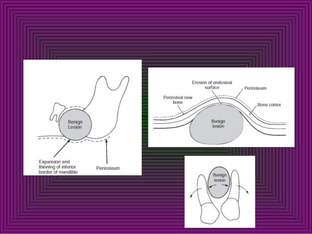 5. odontogenic tumor (1)
