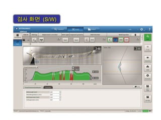 검사 화면검사 화면 (S/W)(S/W)
 