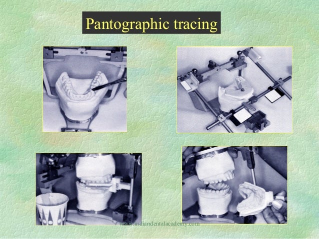 Straight Line Articulator : Articulators dental crown bridge courses