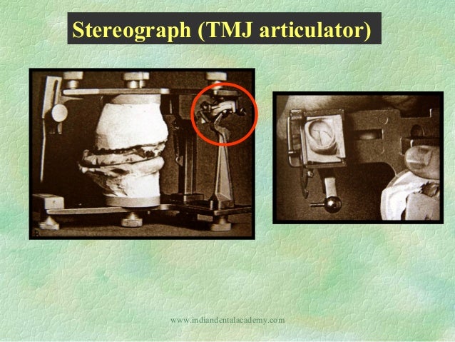 Straight Line Articulator : Articulators dental crown bridge courses