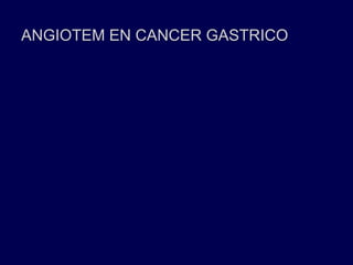 ANGIOTEM EN CANCER GASTRICO
 