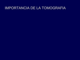 IMPORTANCIA DE LA TOMOGRAFIA
 