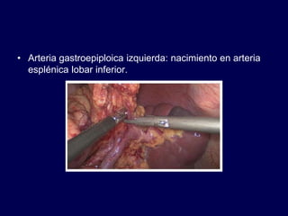 • Arteria gastroepiploica izquierda: nacimiento en arteria
esplénica lobar inferior.
 