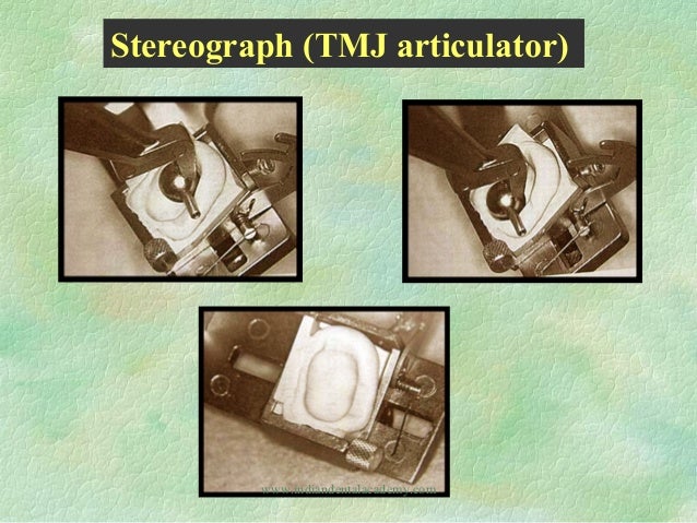Straight Line Articulator : Articulators dental courses